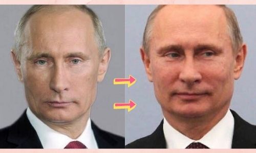 プーチン大統領が認知症と疑われる顔の変化